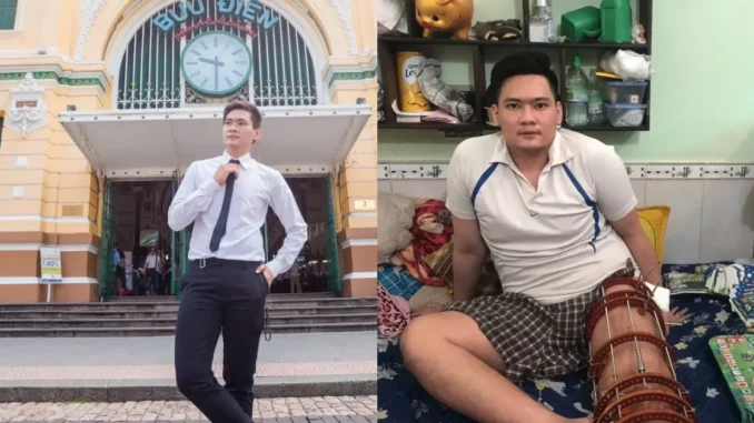 Thầy giáo thể dục mắc ung thư xương ở tuổ.i 25 Thầy giáo thể dục mắc ung thư xương ở tuổ.i 25