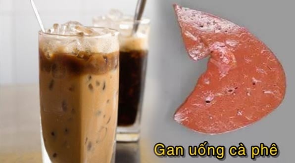 4 giờ vàng uống cà phê giúp cơ thể ‘hưởng lợi’ đủ đường, tiêu hóa tốt, gan được bảo vệ