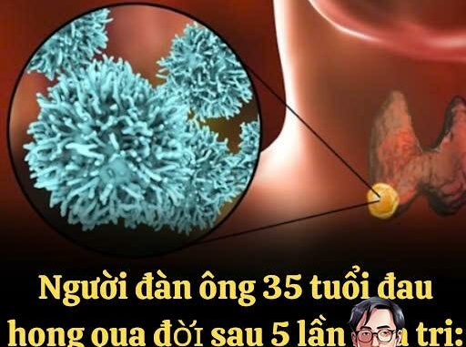 Người đàn ông 35 tuổi đau họng t:uvo:::ng sau 5 lần hóa trị, bác sĩ khẩn cầu: Vứt 2 thứ trong tủ lạnh đi