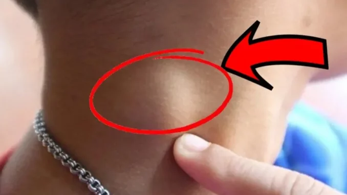 Người sắp bị K tấn công thường có 3 dấu hiệu lạ ở cổ, có 1 cái thôi đã là báo động Người sắp bị K tấn công thường có 3 dấu hiệu lạ ở cổ, có 1 cái thôi đã là báo động