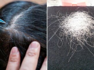 Thường xuyên nhổ tóc bạc, tóc sâu gây ra 4 tác hại này