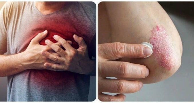 8 dấu hiệu cảnh báo thận không khoẻ 8 dấu hiệu cảnh báo thận không khoẻ