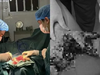 Nát bàn tay vì dùng điện thoại khi đang sạc pin