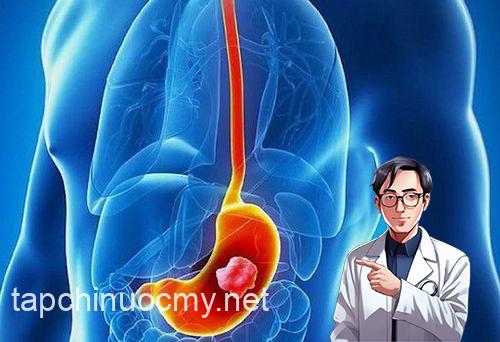 9 triệu chứng UT dạ dày giai đoạn đầu giúp phát hiện sớm bệnh 9 triệu chứng UT dạ dày giai đoạn đầu giúp phát hiện sớm bệnh