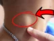 Người sắp bị K tấn công thường có 3 dấu hiệu lạ ở cổ, số 1 nguy hiểm nhất