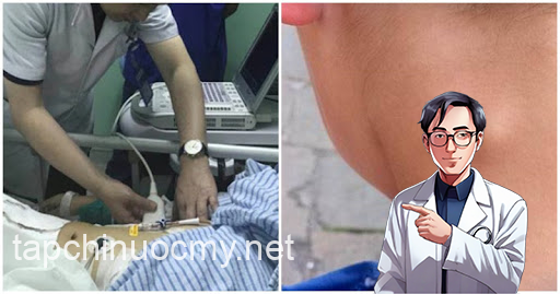Sắp bị ung thư, cơ thể cùng lúc xuất hiện 5 dấu hiệu: Đau bất thường, ho kéo dài hãy gặp BS ngay còn kịp