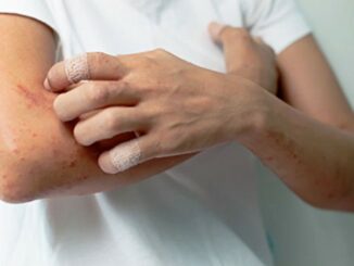 Cẩn trọng khi ngứa ở 2 bộ phận này, có thể là ung thư gan chứ không phải dị ứng