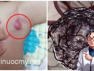 9 triệu chứng ‘điển hình’ báo hiệu trẻ nhỏ bị ung thư giai đoạn đầu: Mẹ đưa con đến viện ngay