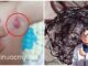 9 triệu chứng ‘điển hình’ báo hiệu trẻ nhỏ bị ung thư giai đoạn đầu: Mẹ đưa con đến viện ngay