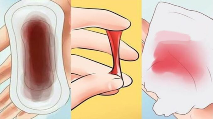 5 dấu hiệu u-ng thư cổ t-ử cung sớm nhất: 90% chị em xem thường bỏ qua 5 dấu hiệu u-ng thư cổ t-ử cung sớm nhất: 90% chị em xem thường bỏ qua