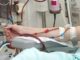 Suy thận t-ấ-n công người trẻ: 1 dấu hiệu sớm có thể là có thể là “tín hiệu cầu cứu”